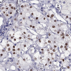 Immunohistochemical staining of human adrenal gland shows high expression.
