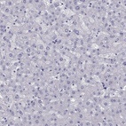 Immunohistochemical staining of human liver shows low expression as expected.