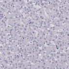 Anti-PHOX2A Antibody