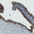 Immunohistochemical staining of human fallopian tube shows strong membranous immunoreactivity in glandular cells.