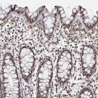 Anti-PWWP2B Antibody