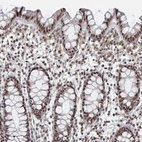 Anti-PWWP2B Antibody