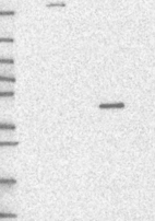 Lane 1: Marker [kDa] 250, 130, 95, 72, 55, 36, 28, 17, 10 | Lane 2: RT4 | Lane 3: U-251 MG | Lane 4: Human Plasma | Lane 5: Liver | Lane 6: Tonsil
