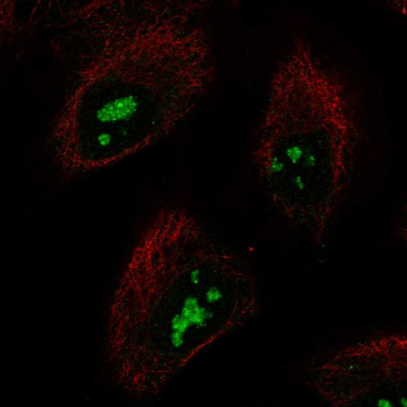 Anti-SMKR1 Antibody