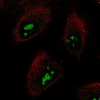 Anti-SMKR1 Antibody