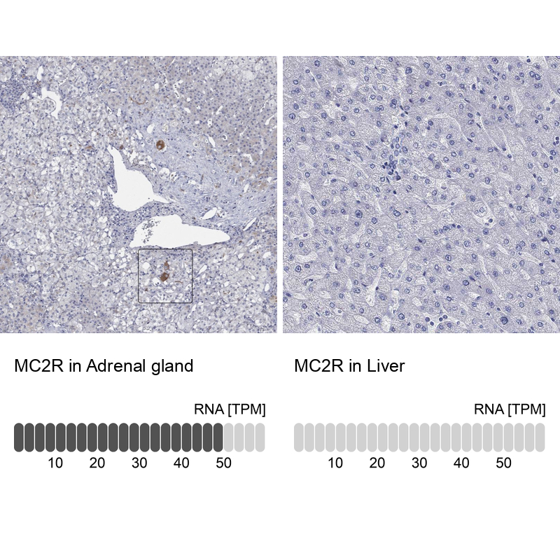 Anti-MC2R Antibody