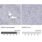 Anti-MC2R Antibody