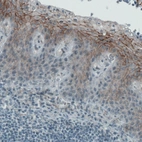 Immunohistochemical staining of human tonsil shows membranous immunoreactivity in squamous epithelium cells.