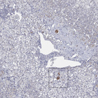 Immunohistochemical staining of human adrenal gland shows strong cytoplasmic positivity in a subset of single neuroendocrine cells.