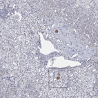 Immunohistochemical staining of human adrenal gland shows strong cytoplasmic positivity in a subset of single neuroendocrine cells.