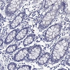 Immunohistochemical staining of human colon shows no cytoplasmic positivity in glandular cells as expected.
