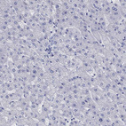 Immunohistochemical staining of human liver shows no cytoplasmic positivity in hepatocytes as expected.