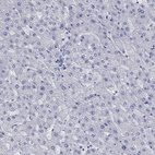 Anti-MC2R Antibody