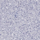 Immunohistochemical staining of human liver shows no cytoplasmic positivity in hepatocytes as expected.