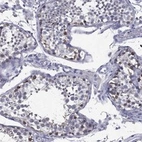 Anti-C19orf18 Antibody