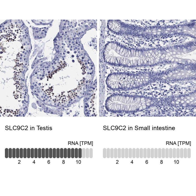 Anti-SLC9C2 Antibody