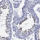 Immunohistochemical staining of human testis shows high expression.