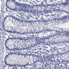Immunohistochemical staining of human small intestine shows low expression as expected.