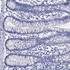 Immunohistochemical staining of human small intestine shows low expression as expected.