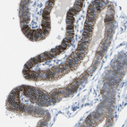 Immunohistochemical staining of human fallopian tube shows strong membranous positivity in glandular cells.