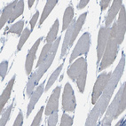 Immunohistochemical staining of human skeletal muscle shows no positivity in myocytes as expected.