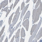 Immunohistochemical staining of human skeletal muscle shows no positivity in myocytes as expected.