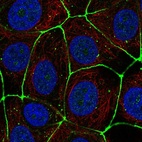 Immunofluorescent staining of human cell line MCF7 shows localization to cell junctions.