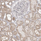 Immunohistochemical staining of human kidney shows weak cytoplasmic positivity in cells in tubules.