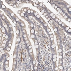 Immunohistochemical staining of human colon shows weak cytoplasmic positivity in glandular cells.