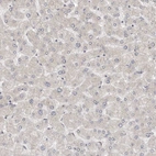 Immunohistochemical staining of human liver shows no positivity in hepatocytes as expected.