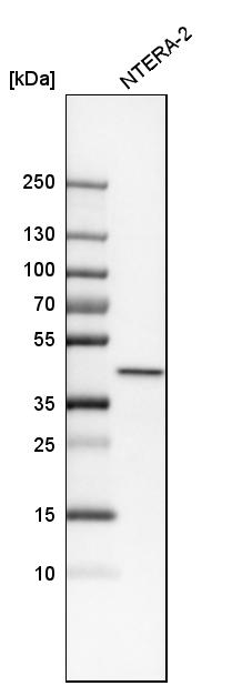Anti-PPP1R8 Antibody