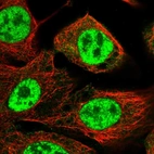 Immunofluorescent staining of human cell line A-431 shows localization to nuclear speckles.