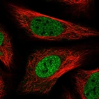 Immunofluorescent staining of human cell line U-2 OS shows localization to nucleoplasm.