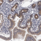 Immunohistochemical staining of human duodenum shows strong cytoplasmic-membranous positivity in glandular cells.
