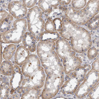 Immunohistochemical staining of human kidney shows moderate cytoplasmic-membranous positivity in cells in tubules.
