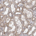Immunohistochemical staining of human kidney shows moderate cytoplasmic-membranous positivity in cells in tubules.