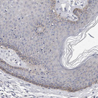 Immunohistochemical staining of human skin shows weak cytoplasmic-membranous positivity in squamous epithelial cells.