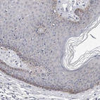Immunohistochemical staining of human skin shows weak cytoplasmic-membranous positivity in squamous epithelial cells.