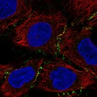 Immunofluorescent staining of human cell line RT4 shows localization to cell junctions.
