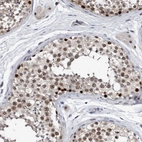 Immunohistochemical staining of human testis shows moderate nuclear positivity in cells in seminiferous ducts.