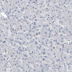Immunohistochemical staining of human liver shows no positivity in hepatocytes as expected.