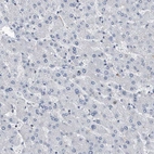 Immunohistochemical staining of human liver shows no positivity in hepatocytes as expected.