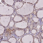 Immunohistochemical staining of human thyroid gland shows moderate membranous positivity in glandular cells.