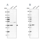 Western blot analysis using Anti-PCNA antibody HPA030521 (A) shows similar pattern to independent antibody HPA030523 (B).