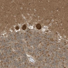 Immunohistochemical staining of human cerebellum shows strong cytoplasmic positivity in Purkinje cells.