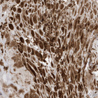 Immunohistochemical staining of human placenta shows strong cytoplasmic positivity in decidual cells.