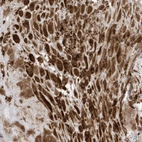Immunohistochemical staining of human placenta shows strong cytoplasmic positivity in decidual cells.