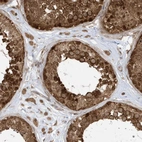 Immunohistochemical staining of human testis shows strong cytoplasmic positivity in cells in seminiferous ducts.