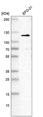 Western blot analysis in human cell line EFO-21.
