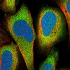 Immunofluorescent staining of human cell line U-2 OS shows localization to cytosol.
